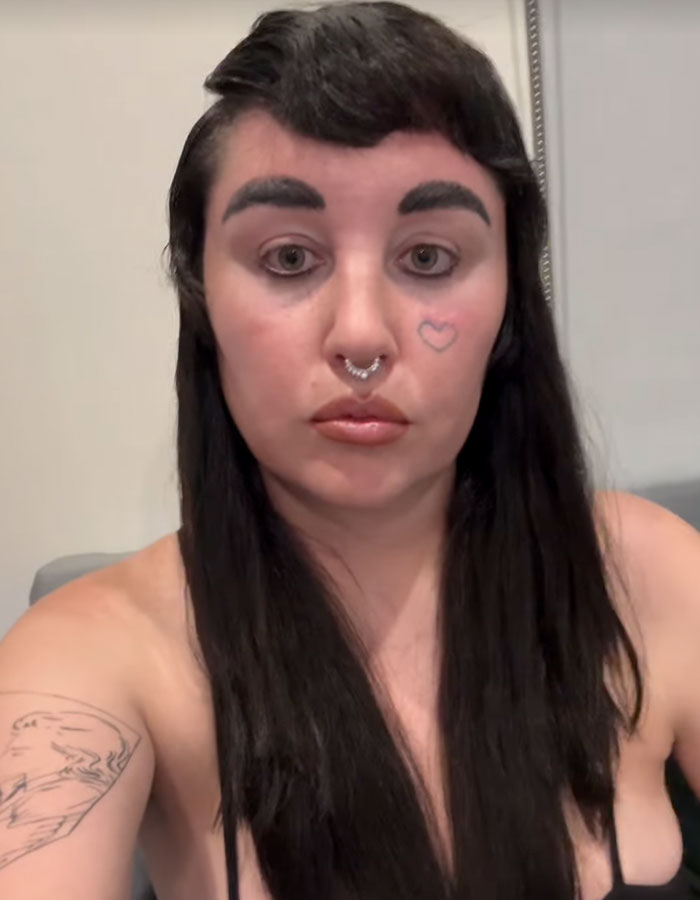 &#8220;Love The Lips&#8221;: Amanda Bynes Shocks Fans With Transformation After Revealing New Cosmetic Procedures