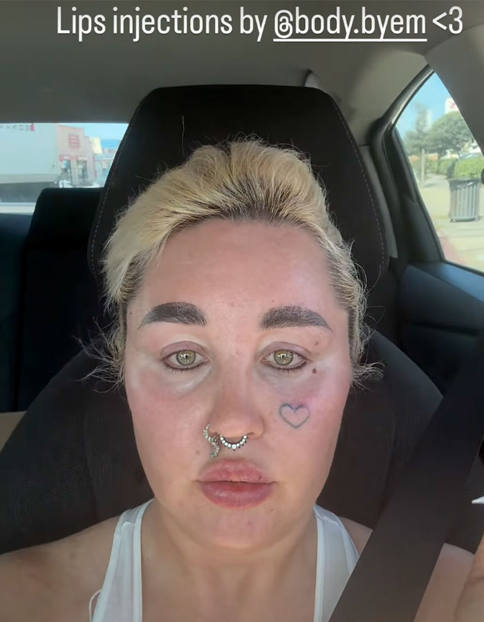 &#8220;Love The Lips&#8221;: Amanda Bynes Shocks Fans With Transformation After Revealing New Cosmetic Procedures