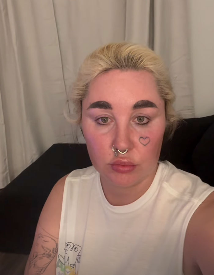 &#8220;Love The Lips&#8221;: Amanda Bynes Shocks Fans With Transformation After Revealing New Cosmetic Procedures