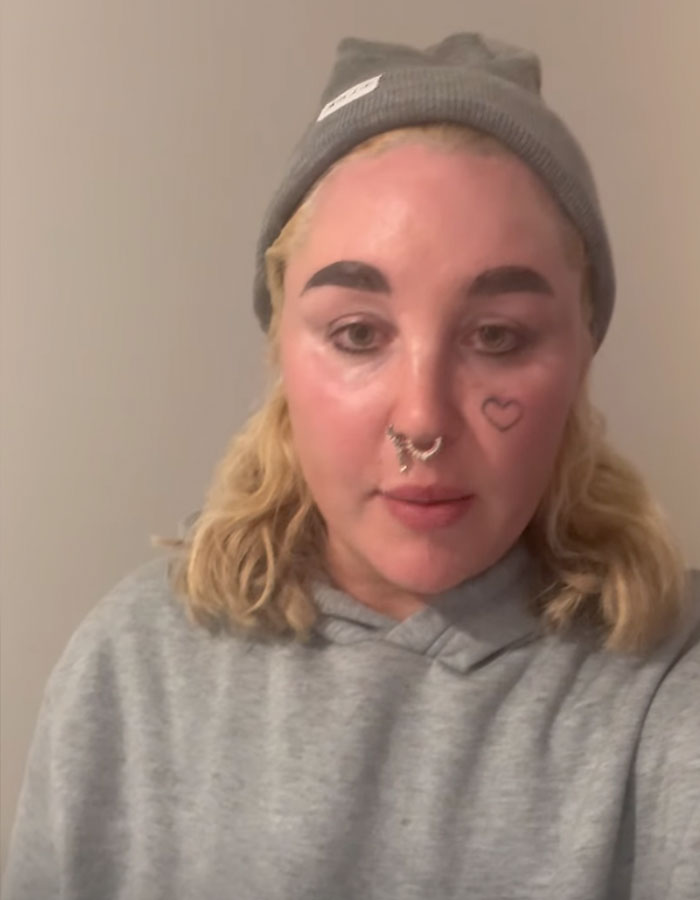 &#8220;Love The Lips&#8221;: Amanda Bynes Shocks Fans With Transformation After Revealing New Cosmetic Procedures