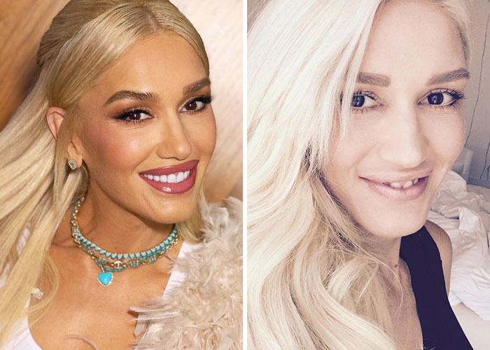 31 Celebrities Seen Without Makeup, Lighting, Or Professional Cameras