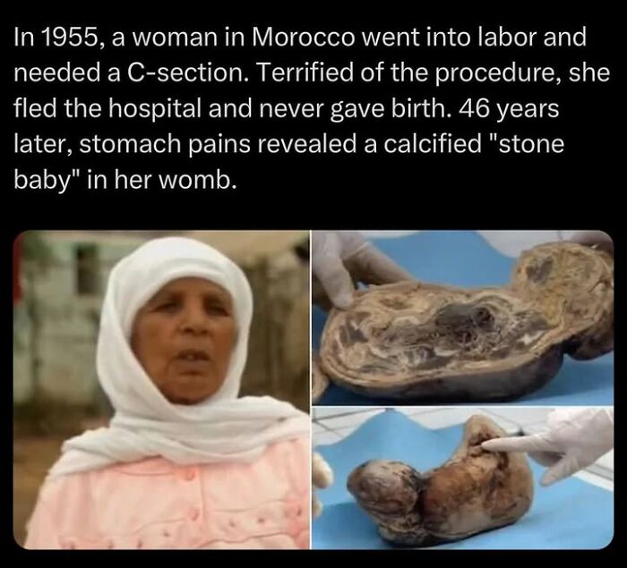 90 Random Creepy Facts And Pictures To Deprive Somebody Of Sleep