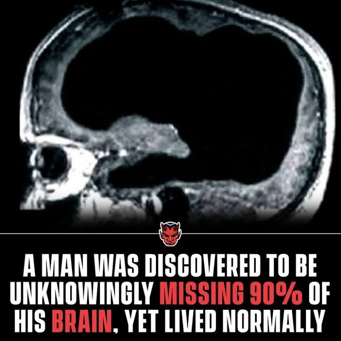90 Random Creepy Facts And Pictures To Deprive Somebody Of Sleep