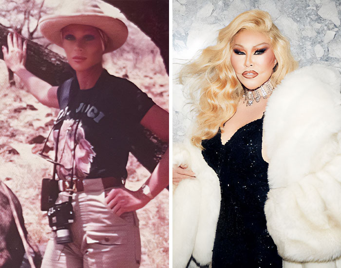 20 Before-And-After Pictures Of Celebs Who Went Too Far With Plastic Surgery