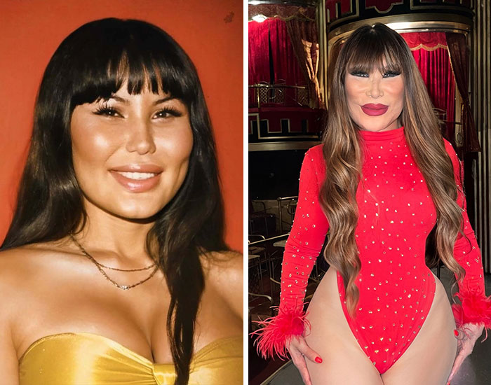 20 Before-And-After Pictures Of Celebs Who Went Too Far With Plastic Surgery