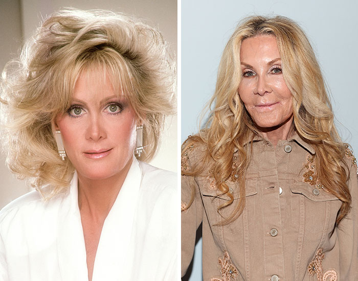 20 Before-And-After Pictures Of Celebs Who Went Too Far With Plastic Surgery