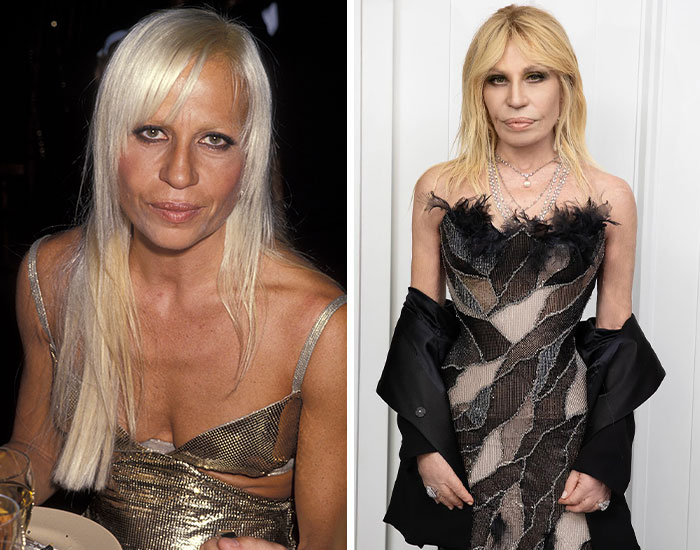 20 Before-And-After Pictures Of Celebs Who Went Too Far With Plastic Surgery