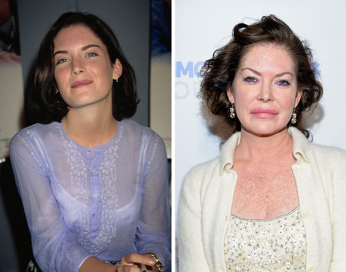 20 Before-And-After Pictures Of Celebs Who Went Too Far With Plastic Surgery