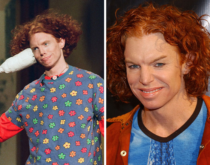 20 Before-And-After Pictures Of Celebs Who Went Too Far With Plastic Surgery