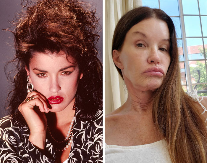 20 Before-And-After Pictures Of Celebs Who Went Too Far With Plastic Surgery