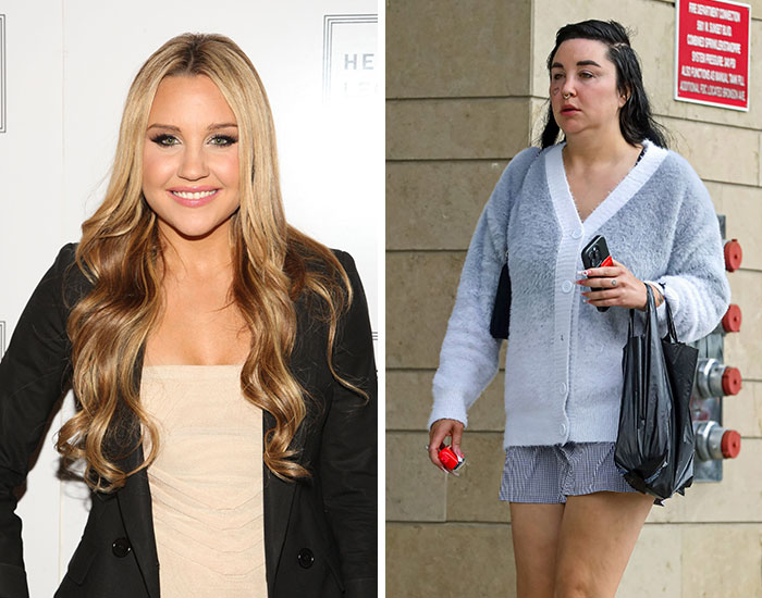 20 Before-And-After Pictures Of Celebs Who Went Too Far With Plastic Surgery