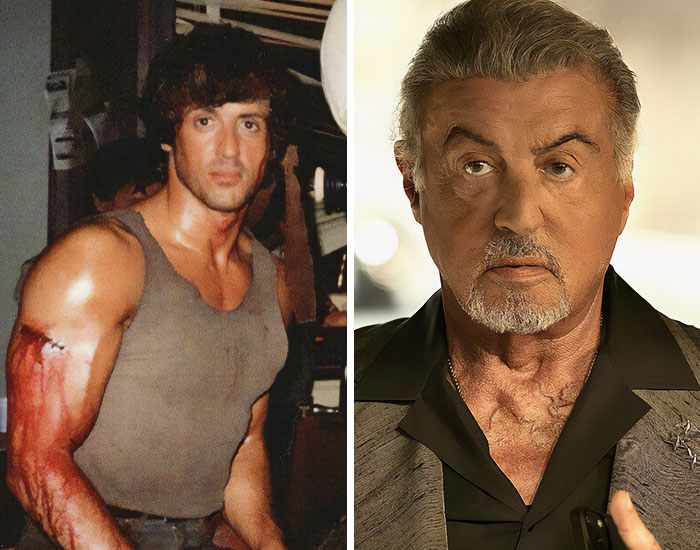 20 Before-And-After Pictures Of Celebs Who Went Too Far With Plastic Surgery