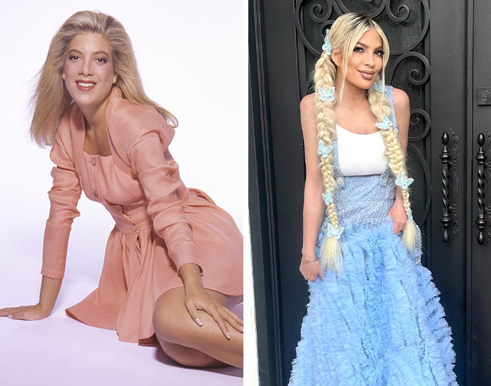 20 Before-And-After Pictures Of Celebs Who Went Too Far With Plastic Surgery