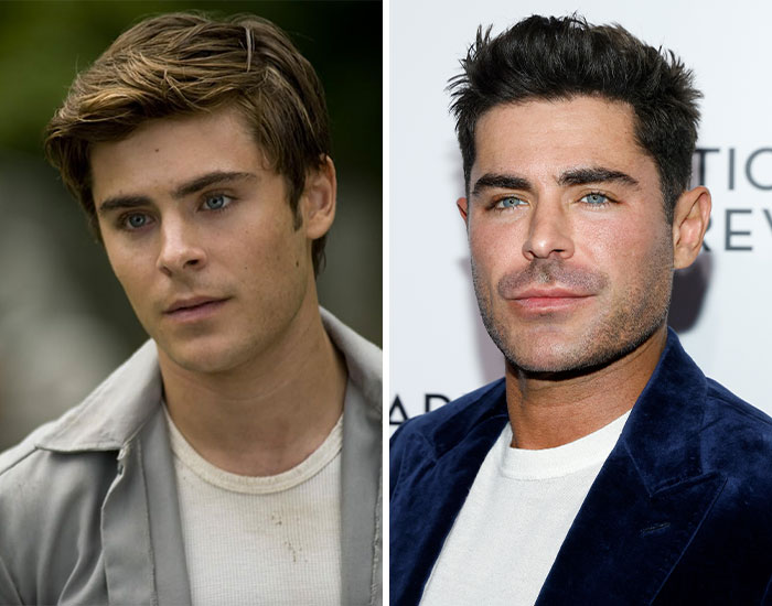 20 Before-And-After Pictures Of Celebs Who Went Too Far With Plastic Surgery