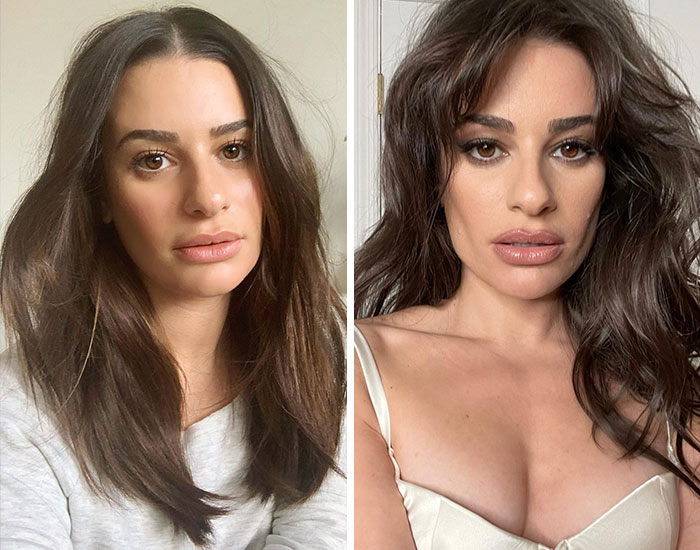 20 Before-And-After Pictures Of Celebs Who Went Too Far With Plastic Surgery