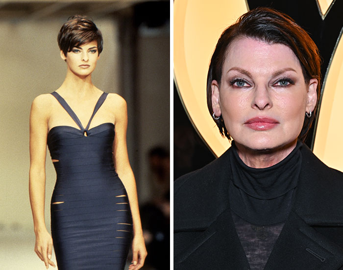 20 Before-And-After Pictures Of Celebs Who Went Too Far With Plastic Surgery