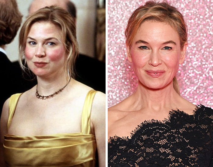 20 Before-And-After Pictures Of Celebs Who Went Too Far With Plastic Surgery
