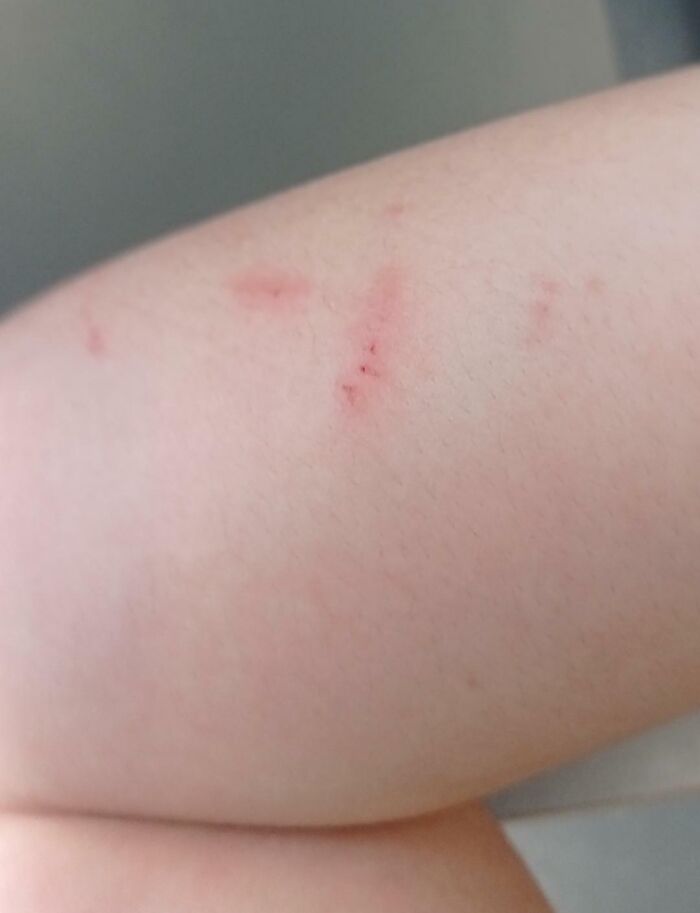 50 Photos That Show What It’s Like To Have An Entitled Sibling