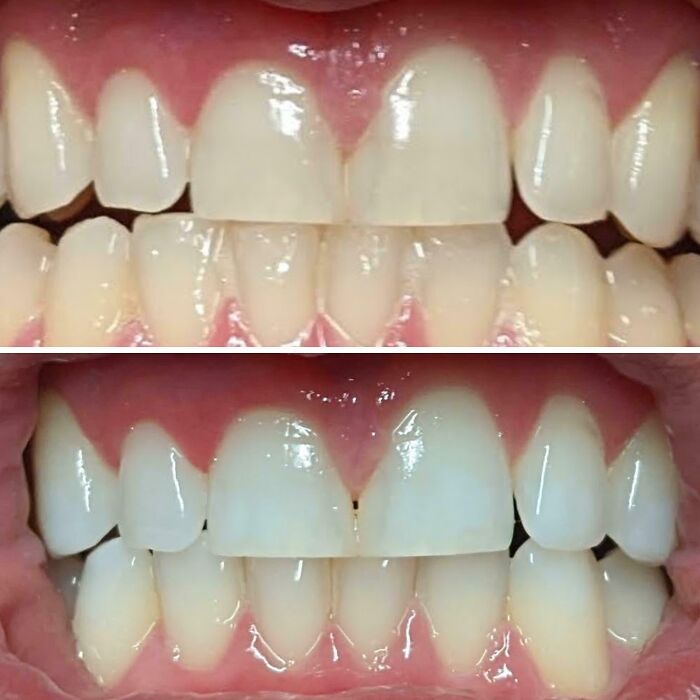 71 Comparisons Nobody Asked For But You Might Be Interested To See (New Pics)