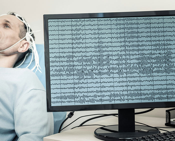 Man Who Hasn&#8217;t Slept In 2 Years Is Begging Experts To Solve His Medical Mystery: &#8220;My Eyes Are Melting&#8221;