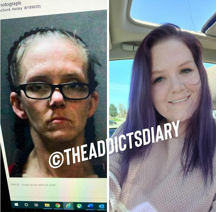 50 Before-And-After Pics And Inspiring Stories About Life-Changing Recoveries
