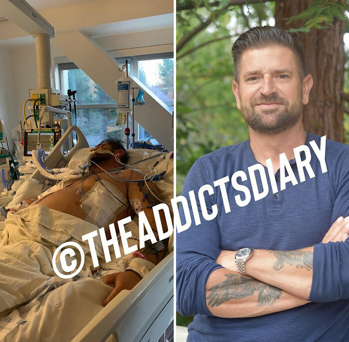 50 Before-And-After Pics And Inspiring Stories About Life-Changing Recoveries