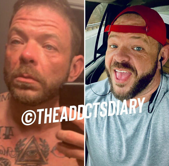 50 Before-And-After Pics And Inspiring Stories About Life-Changing Recoveries