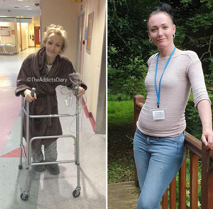 50 Before-And-After Pics And Inspiring Stories About Life-Changing Recoveries