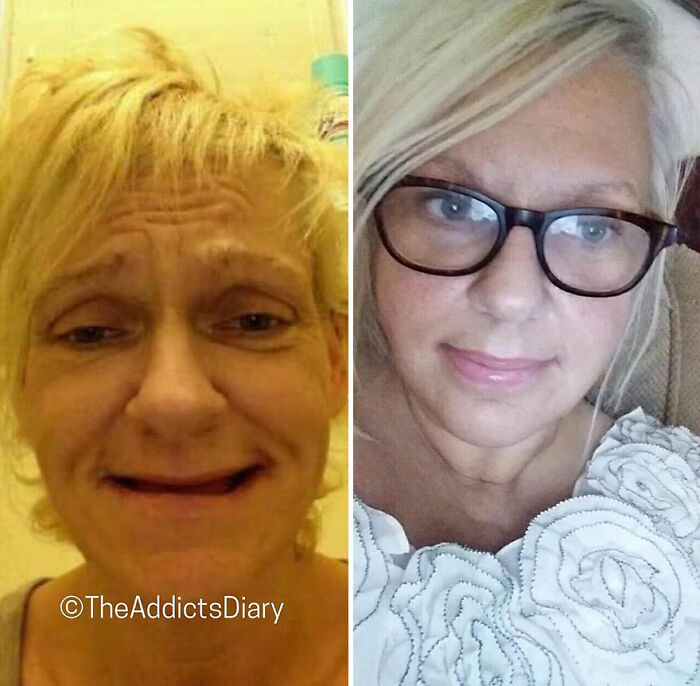 50 Before-And-After Pics And Inspiring Stories About Life-Changing Recoveries