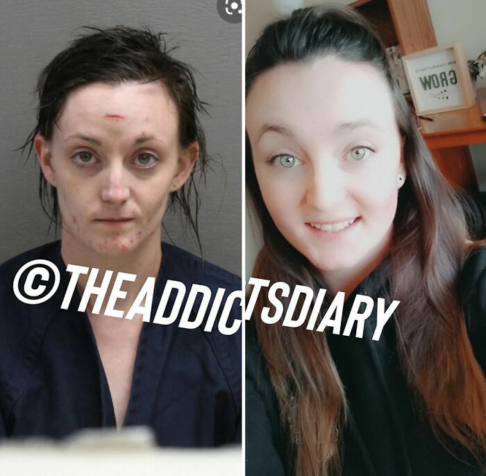 50 Before-And-After Pics And Inspiring Stories About Life-Changing Recoveries