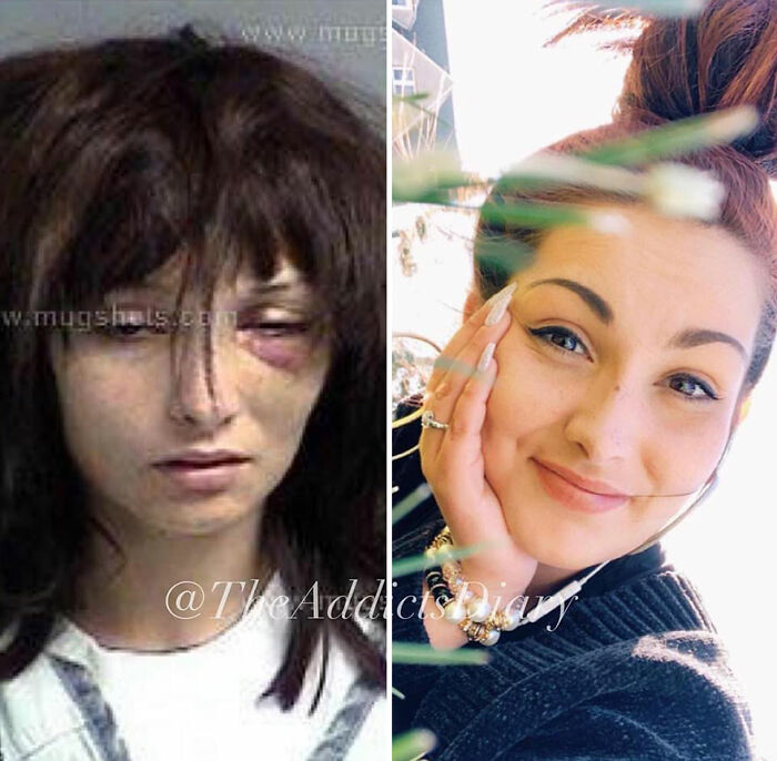50 Before-And-After Pics And Inspiring Stories About Life-Changing Recoveries