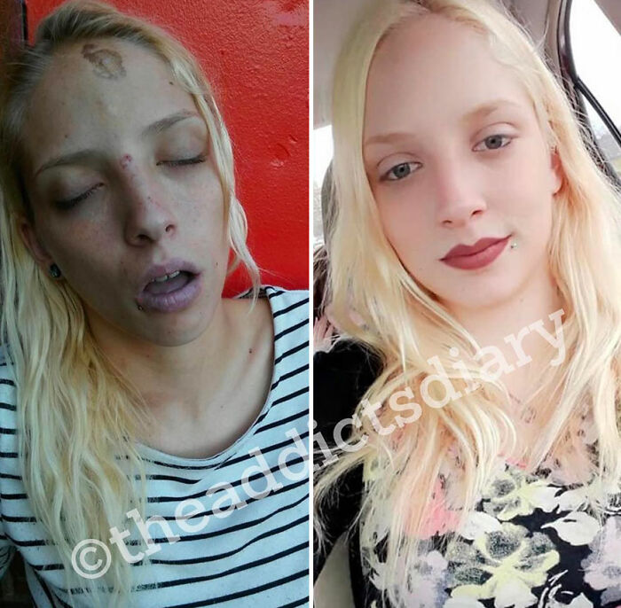 50 Before-And-After Pics And Inspiring Stories About Life-Changing Recoveries