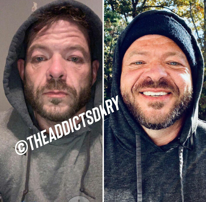 50 Before-And-After Pics And Inspiring Stories About Life-Changing Recoveries