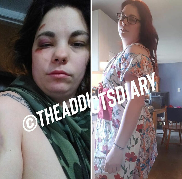 50 Before-And-After Pics And Inspiring Stories About Life-Changing Recoveries