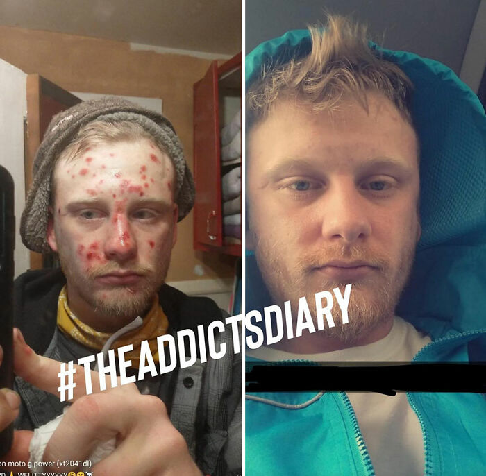 50 Before-And-After Pics And Inspiring Stories About Life-Changing Recoveries