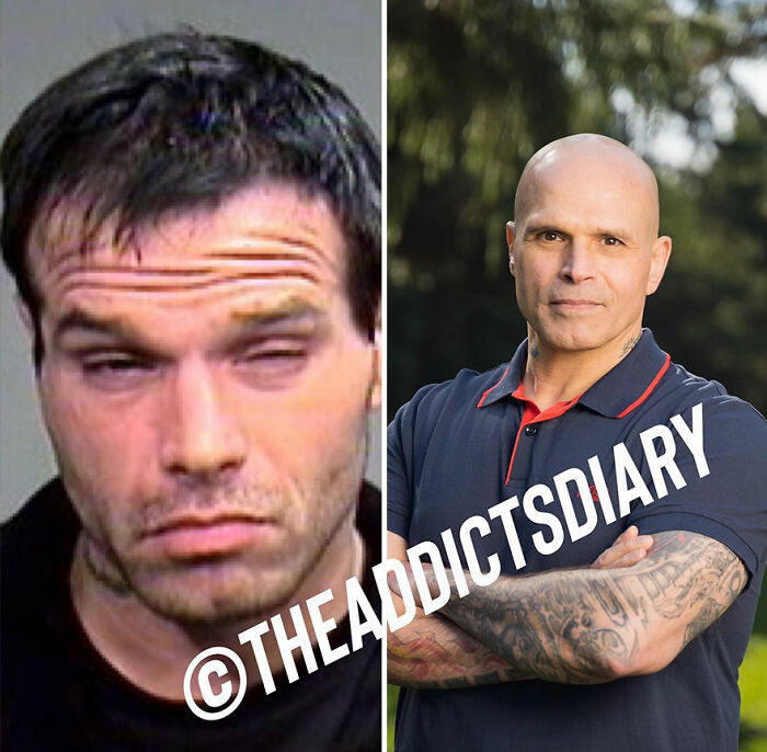 50 Before-And-After Pics And Inspiring Stories About Life-Changing Recoveries