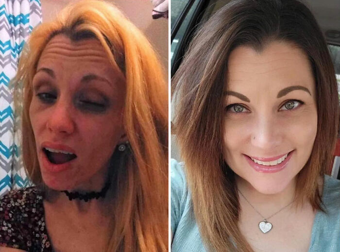 50 Before-And-After Pics And Inspiring Stories About Life-Changing Recoveries