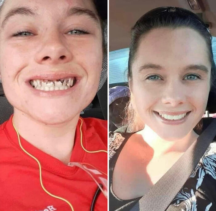 50 Before-And-After Pics And Inspiring Stories About Life-Changing Recoveries