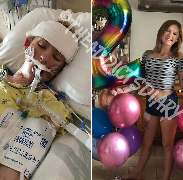 50 Before-And-After Pics And Inspiring Stories About Life-Changing Recoveries