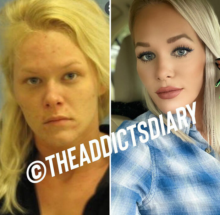 50 Before-And-After Pics And Inspiring Stories About Life-Changing Recoveries