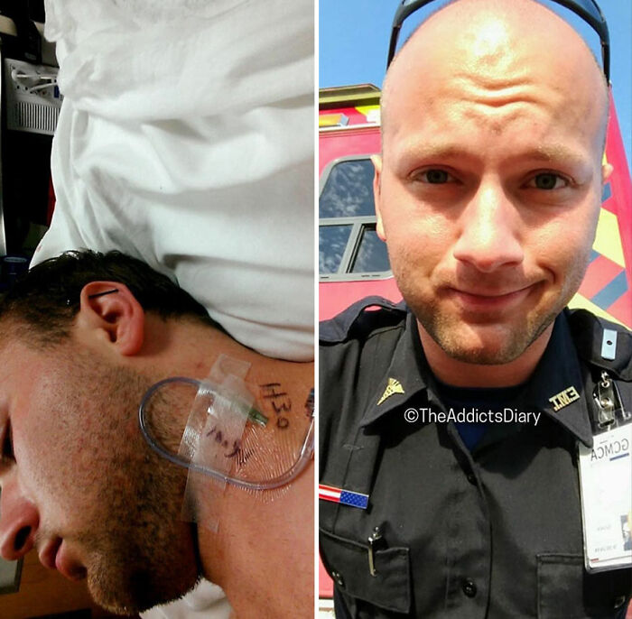 50 Before-And-After Pics And Inspiring Stories About Life-Changing Recoveries