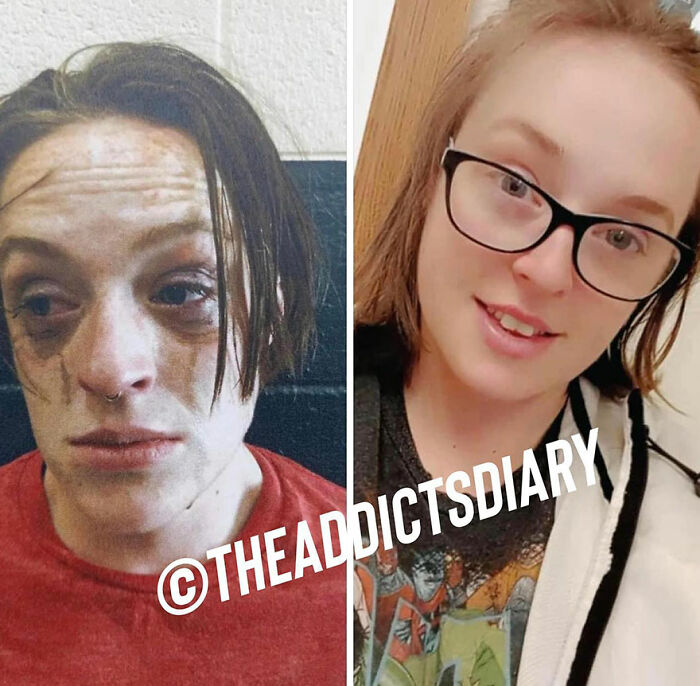 50 Before-And-After Pics And Inspiring Stories About Life-Changing Recoveries