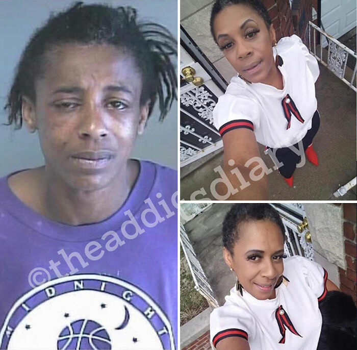 50 Before-And-After Pics And Inspiring Stories About Life-Changing Recoveries