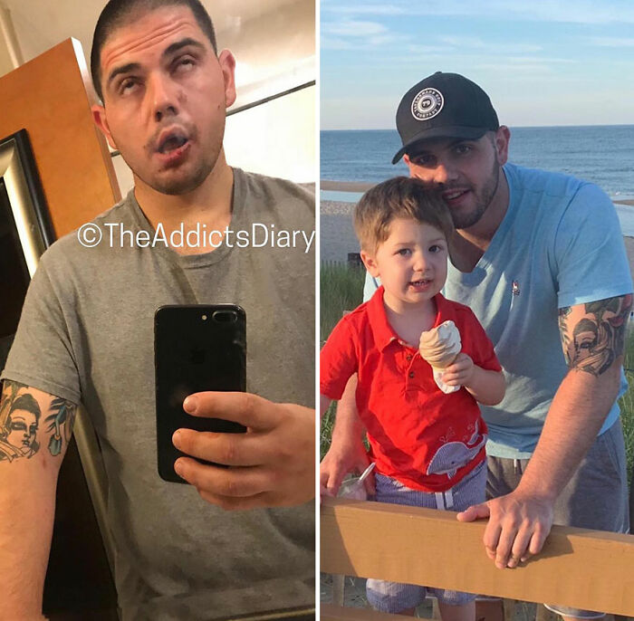 50 Before-And-After Pics And Inspiring Stories About Life-Changing Recoveries