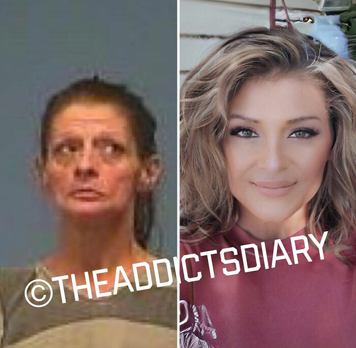 50 Before-And-After Pics And Inspiring Stories About Life-Changing Recoveries