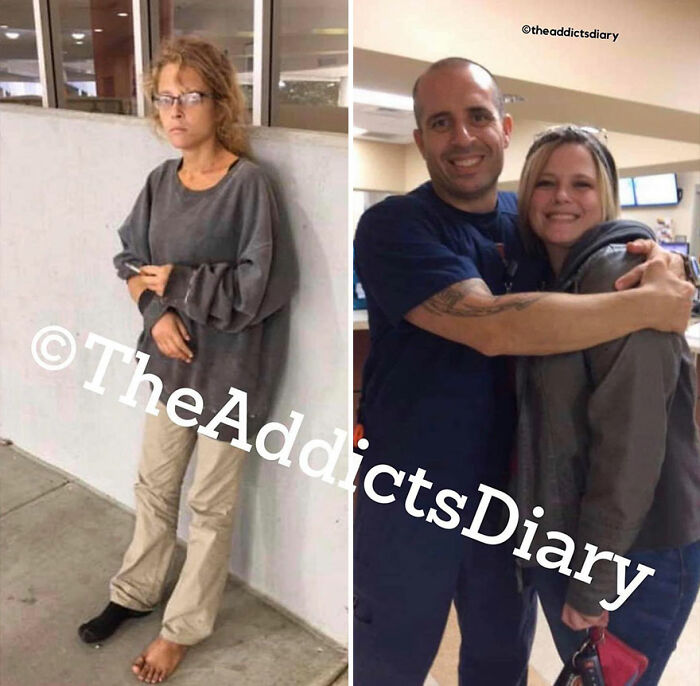 50 Before-And-After Pics And Inspiring Stories About Life-Changing Recoveries