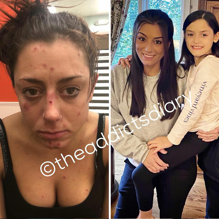 50 Before-And-After Pics And Inspiring Stories About Life-Changing Recoveries