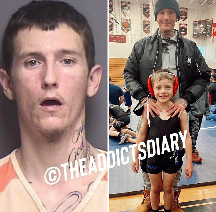 50 Before-And-After Pics And Inspiring Stories About Life-Changing Recoveries