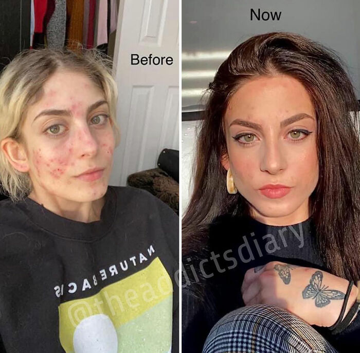50 Before-And-After Pics And Inspiring Stories About Life-Changing Recoveries