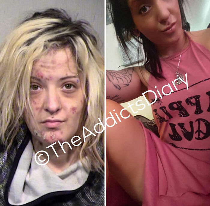 50 Before-And-After Pics And Inspiring Stories About Life-Changing Recoveries